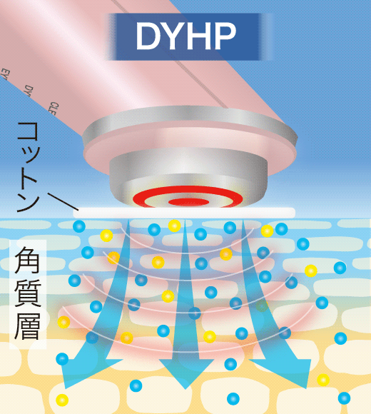 独自の導入プログラム「DYHP（ダイナミックハイパーパルス）」で成分を角質層の奥まで届かせる