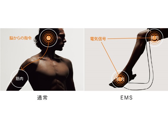 電気刺激によって筋肉トレーニングを サポートするテクノロジー