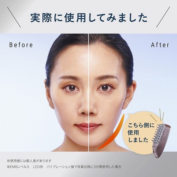 医師監修】スカルプ電気ブラシ|スカルプD ボーテ公式サイト