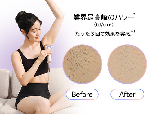 ブラウン BRAUN 家庭用脱毛器 AI搭載光美容器 スキンアイ ブラウン BRAUN 家庭用脱毛器 AI搭載光美容器 スキンアイ