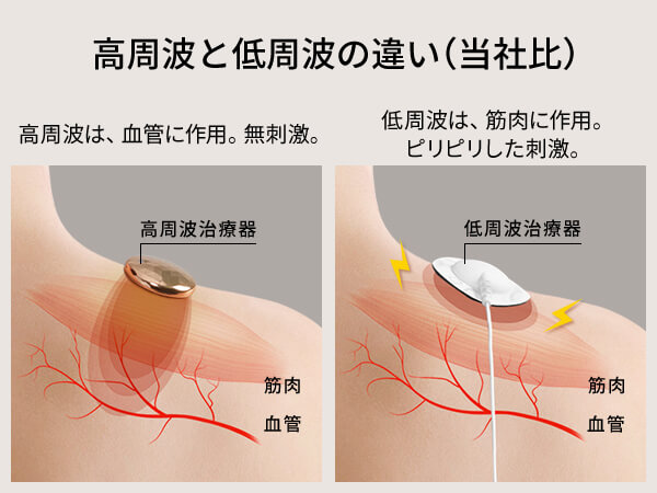 パナソニック Panasonic 高周波治療器 コリコランワイド パナソニック Panasonic 高周波治療器 コリコランワイド