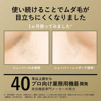 ヤーマン 家庭用脱毛器 光美容器・VIO対応・ハイパワー×ハイスピード