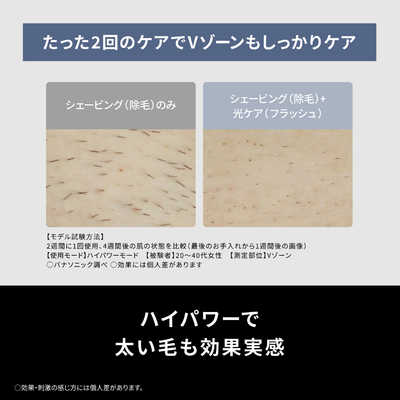 パナソニック Panasonic 家庭用脱毛器 光エステ スムースエピ