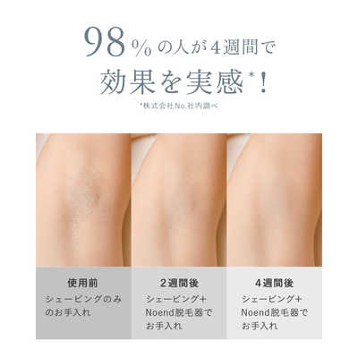 NOEND 家庭用脱毛器 コードレス脱毛器 NB-HR-001 ［フラッシュ式