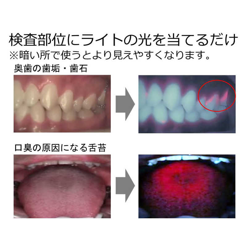 歯っぴー 歯っぴー 歯垢検査ライト Dental Light 歯っぴｰ　赤 HA002 HA002