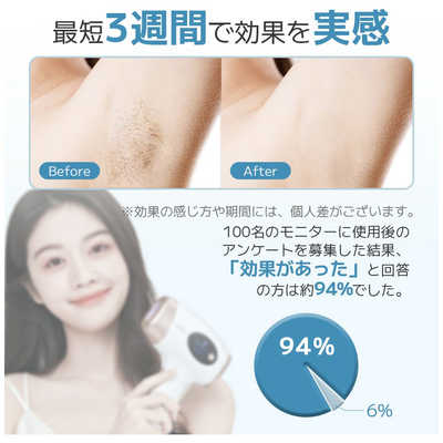 Sarlisi IPL脱毛器 SAJM04WH 60万発 公式】脱毛初心者向けの入門級として、お手頃価格で高機能な脱毛