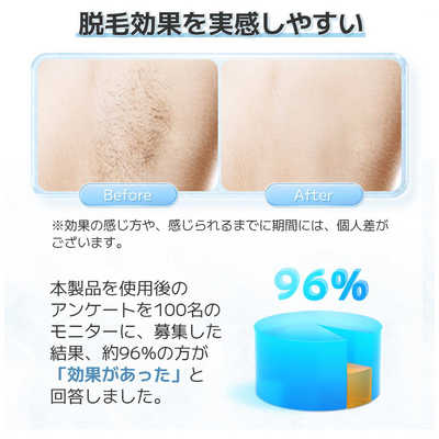 おすすめ】自宅で冷感脱毛？軽量設計のSarlisi家庭用IPL脱毛器は