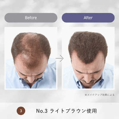 ルアン スーパーミリオンヘアーコンパクトセットNo.1ブラック