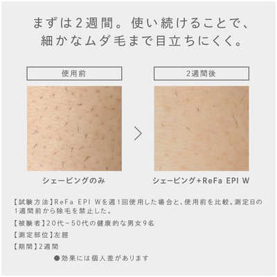 脱毛・除毛 RE-AY-02A MTG 家庭用脱毛器 EPI リファエピW 光脱毛器 フラッシュ式 ReFa