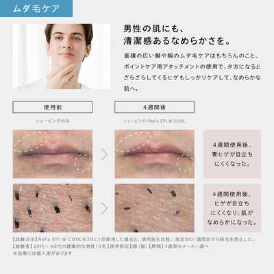 MTG 家庭用脱毛器 光美容器 EPI W COOL エピダブルクール フラッシュ式