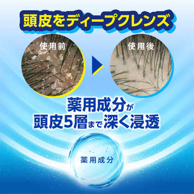 P＆G h＆s モイスチャー シャンプー 詰め替え 超特大サイズ3倍 875g HS