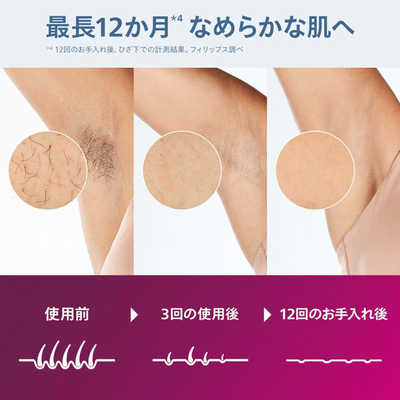 フィリップス PHILIPS 家庭用脱毛器 フィリップス ルメア 光美容器7000